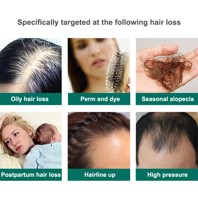 Champú a prueba de caída del cabello, 360g, Zhangguang 101, a base de hierbas chinas, anticaída del cabello, potente para detener la caída del cabello