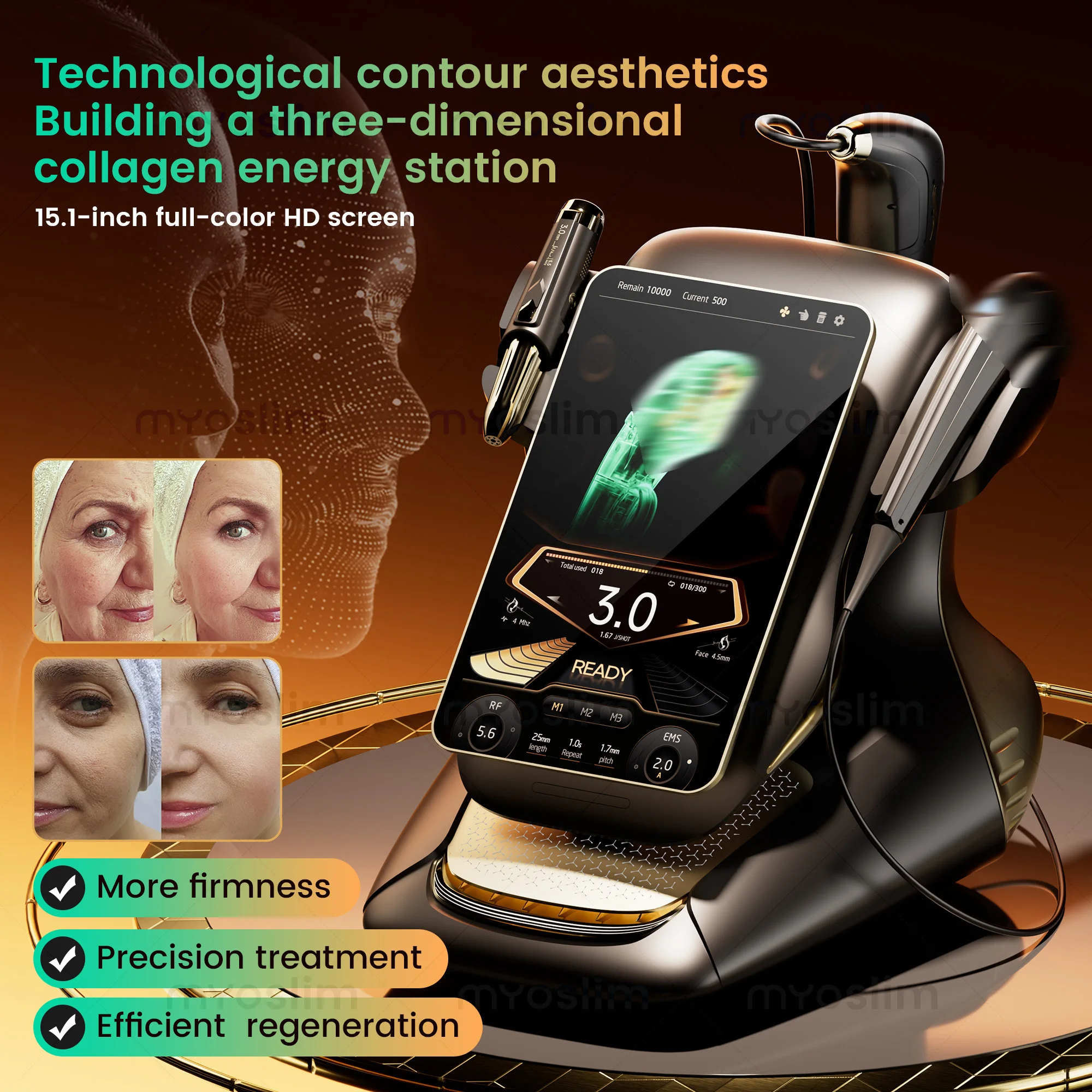 Equipo de Belleza Profesional, Máquina Hifu 25D 360MAX para Lifting Facial, Adelgazamiento y Reducción de Grasa, Último Modelo para Salón de Belleza