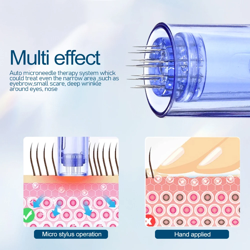 Dr Pen-pluma Derma profesional Ultima A1, microagujas, botón inalámbrico A1, 5 niveles de ajuste, cicatrices, estrías, útil