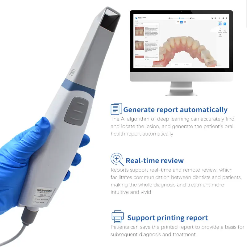 Escáner Intraoral Dental 3D Runyes V3 3.0 Pro, Restauración de Ortodoncia CMD CAD
