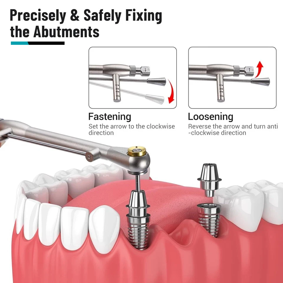 Kit de implante Dental Universal, controlador de muelle, destornillador hexagonal manual, conductores largos + cortos, Kit de llave de torsión protésica