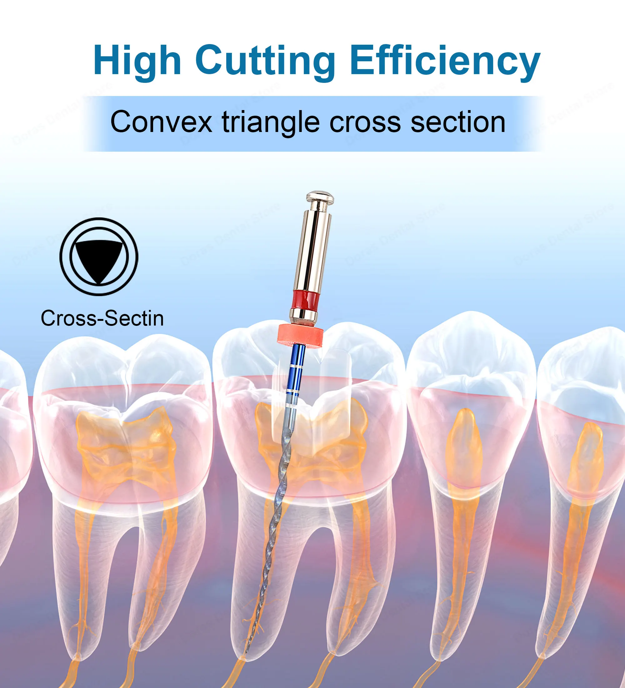 Limas Dentales Rotatorias de Níquel Titanio Glin para Endodoncia, Limas Dentales Azules para Limpieza de Conductos Radiculares, Activación por Calor, 21/25 mm