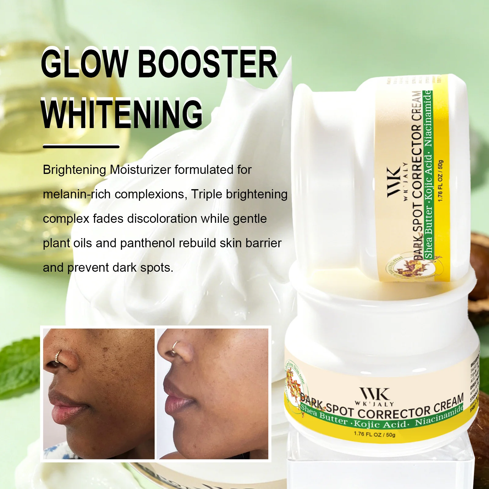 Crema Correctora de Manchas Oscuras WK JALY, Blanqueadora de Piel, Elimina Manchas Oscuras, Melanina, Pecas, Con Niacinamida, Para Todo Tipo de Piel