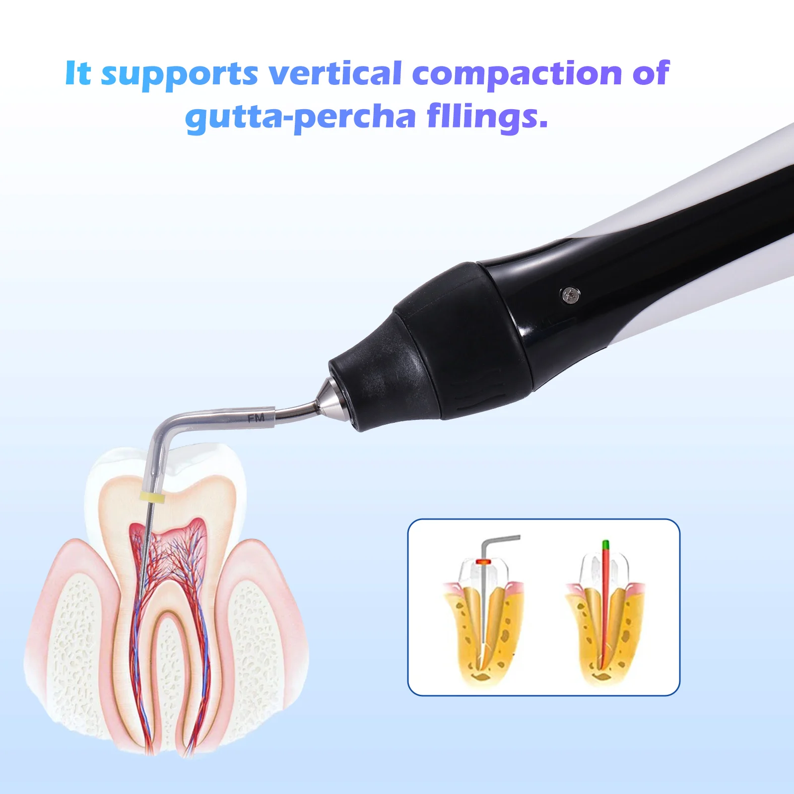 Tratamiento de Motor Endo LED Dental/localizador de ápice buscador de conducto radicular/sistema de obturación de conducto radicular inalámbrico Kit de pistola y bolígrafo/archivos NITI
