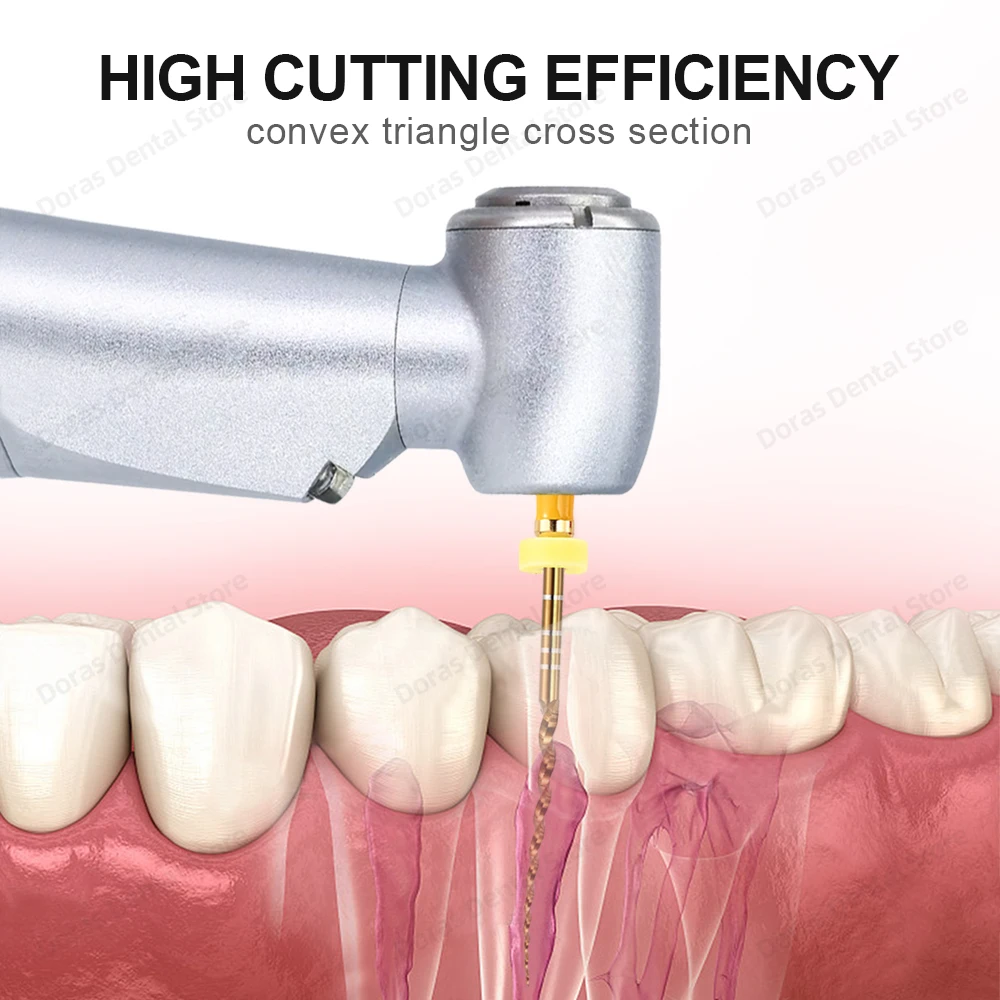 Glin Dental - Limas Flexibles de Oro para Endodoncia, Limas Rotatorias Doradas, 21/25/31 mm, Instrumento de Níquel Titanio para Odontología