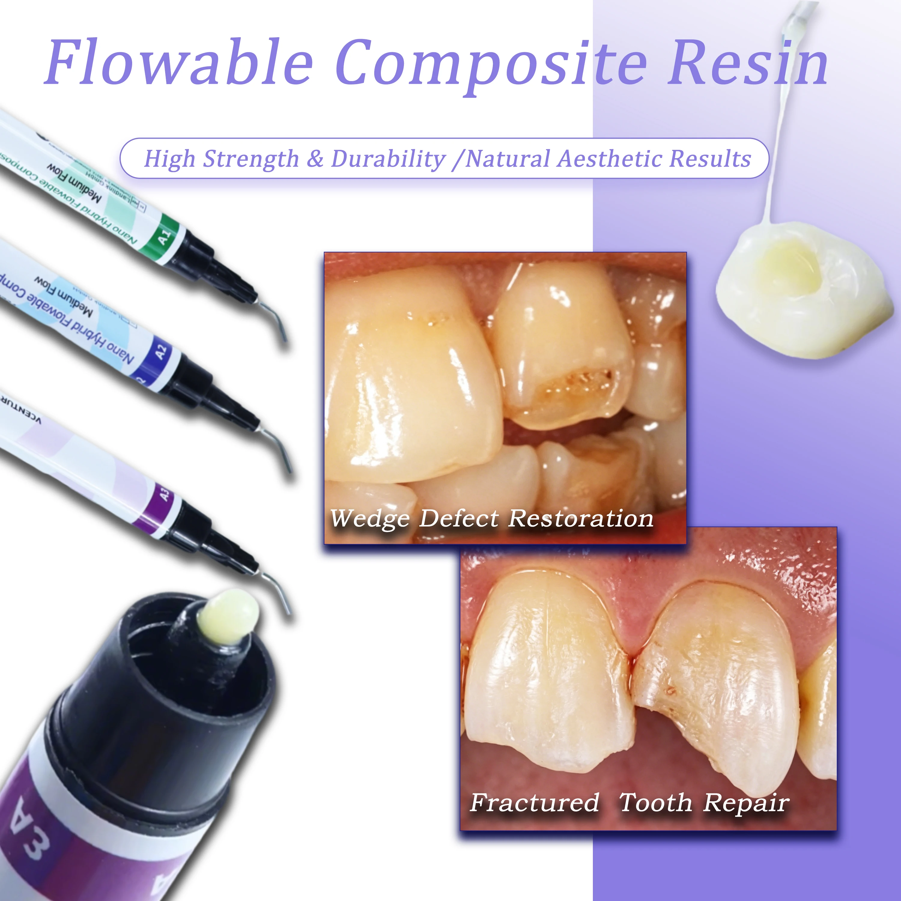 Resina Compuesta Fluida Fotopolimerizable Dental A1-A3.5 con Gel Grabador y Primer Adhesivo para Restauración de Rellenos Orales