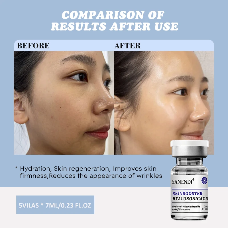 Sanendi SKIN BOOSTER Ácido HialURÓNICO Solución de problemas de la piel facial Hidratación Hidratación Solución de proteínas coreanas para el cuidado de la piel