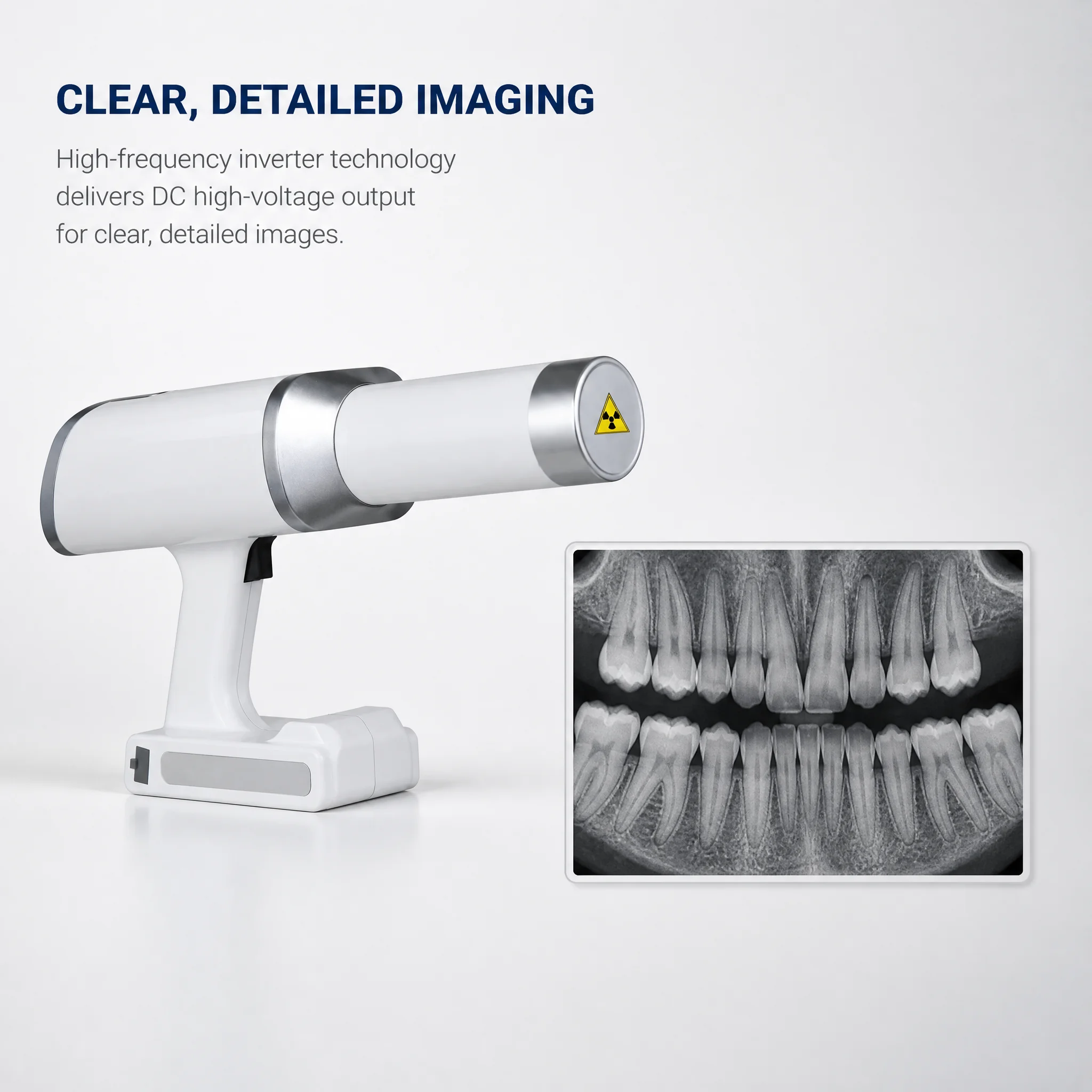 Unidad de Rayos X Dental, Sistema de Imagenología Intraoral Digital RVG, Máquina de Rayos X Portátil para Clínica Dental
