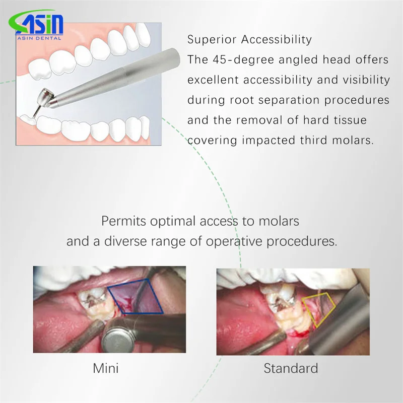 Turbina Dental de fibra óptica con cabezal de 45 grados, pieza de mano LED de alta velocidad para extracción de dientes, tratamiento quirúrgico, odontología