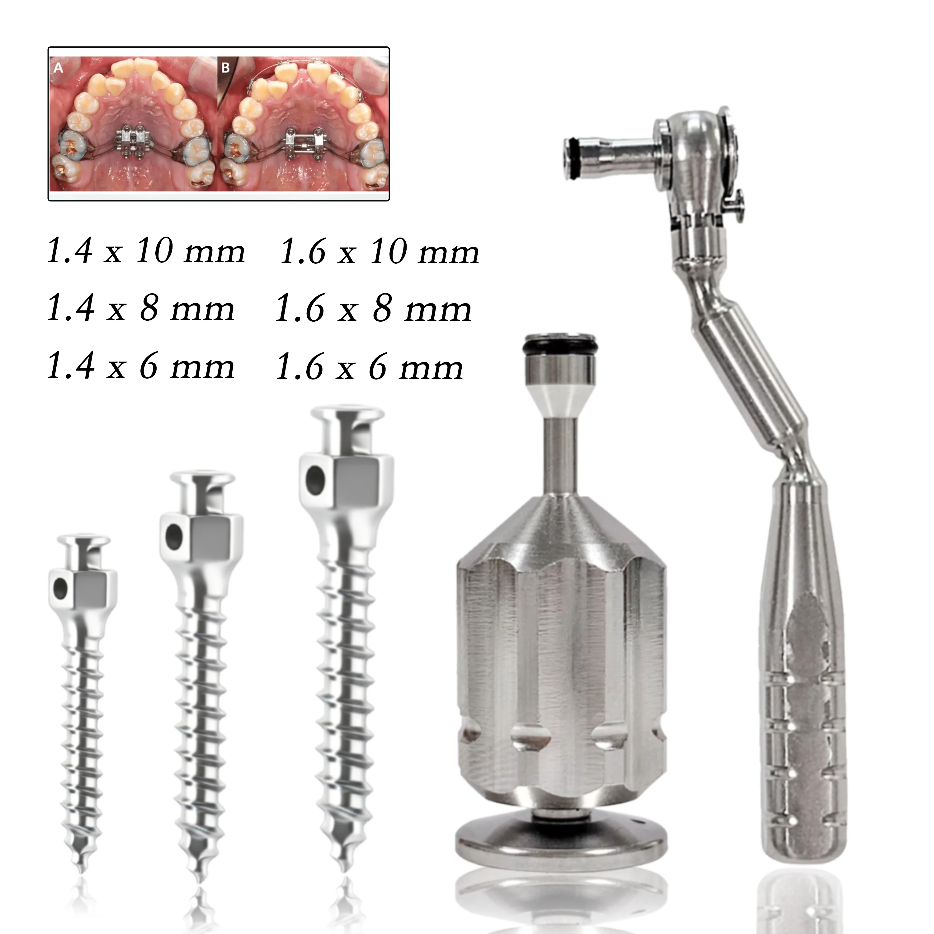 Kit de Llaves de Trinquete para Tornillos de Expansión Ortodónticos Dentales, para Expansor Esquelético Maxilar y Tornillos de Implantes Micro Mini Ortodónticos