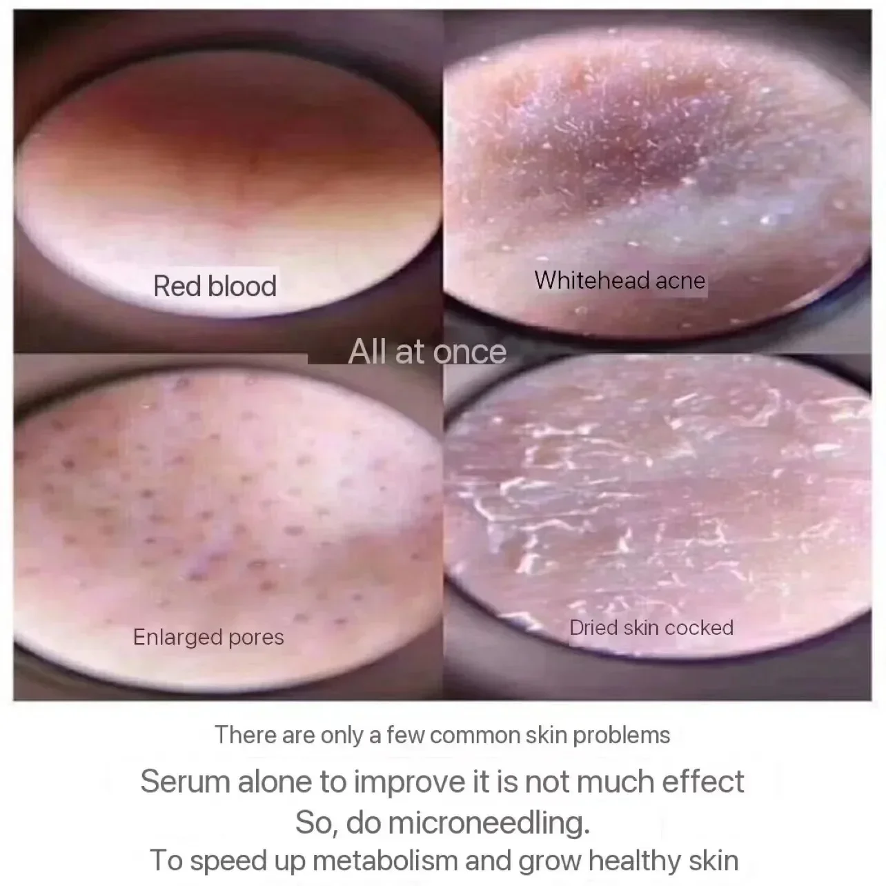 Esponja de microcristal, polvo liofilizado, regeneración de colágeno, extracto biológico Natural, esponjas, renovación de células de la piel, 10 Uds.