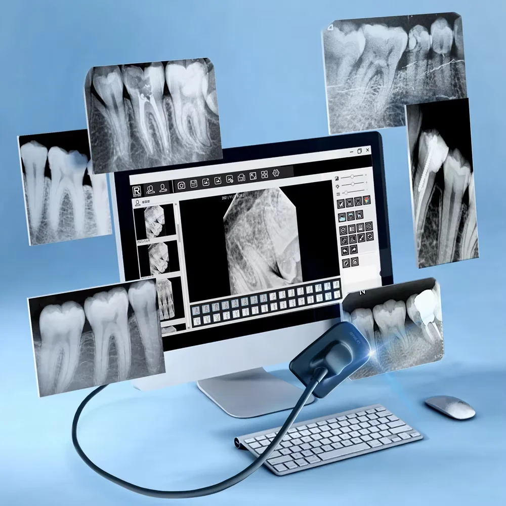 Sensor digital dental JUMTOP Sensor RVG de rayos X con sistema de imagen de alta definición APS CMOS Tech
