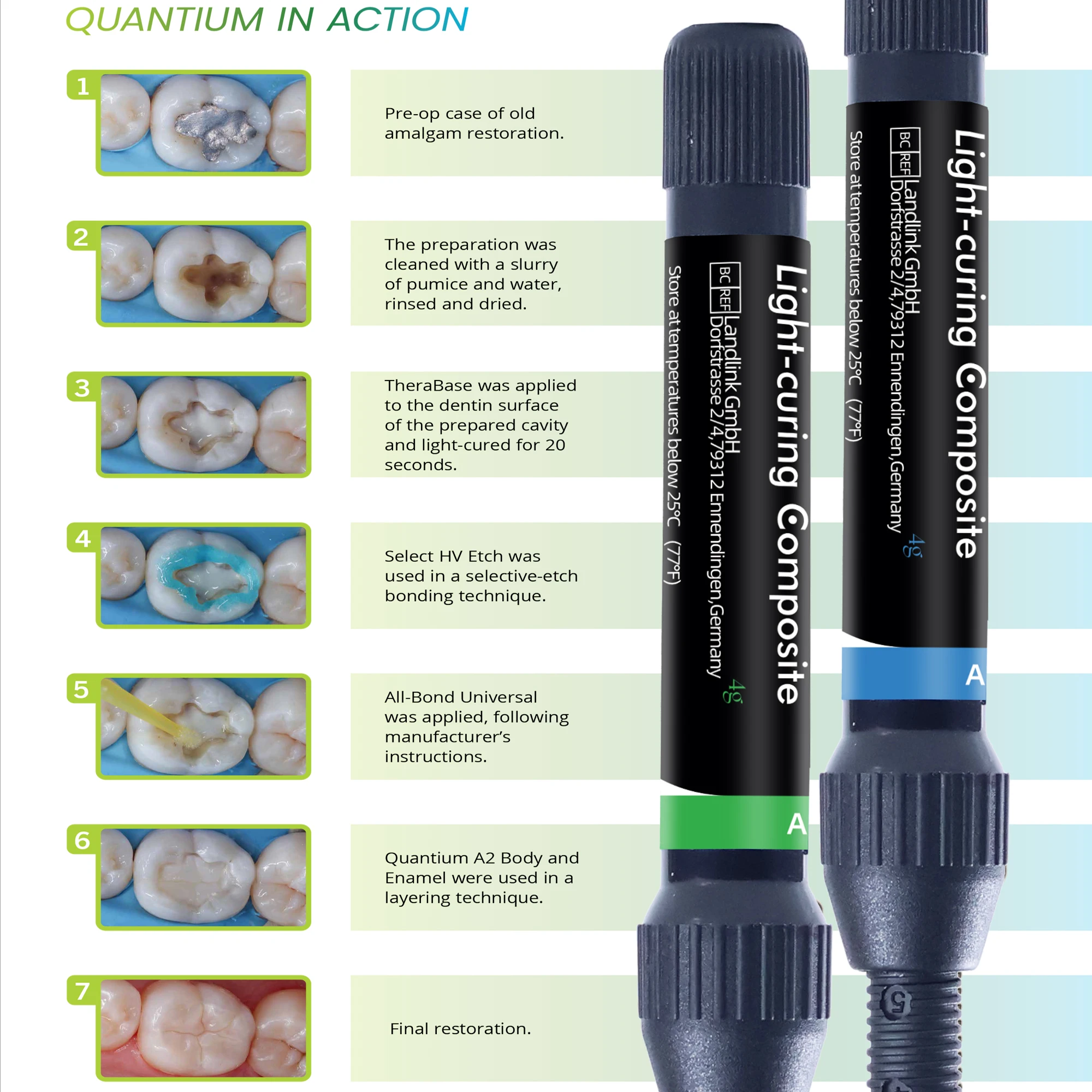 Kit de Resina Compuesta Dental Fotopolimerizable con Gel Grabador y Agente Adhesivo para Restauración de Caries A1/A2/A3