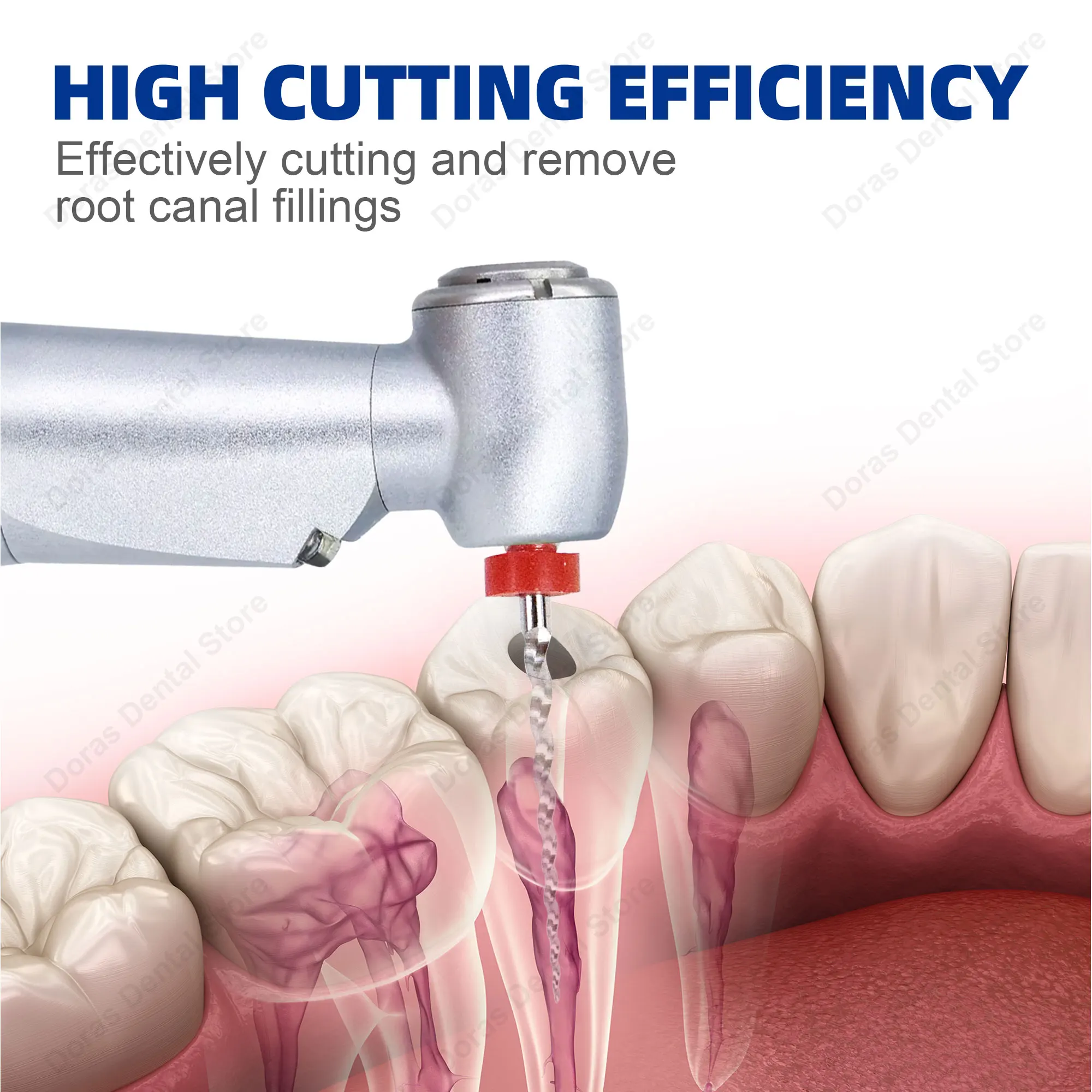 Limas de Retratamiento Glin Dental Super D para Tratamiento de Conducto Radicular, Limas Endodónticas Rotatorias D1-D3, Instrumento de Odontología