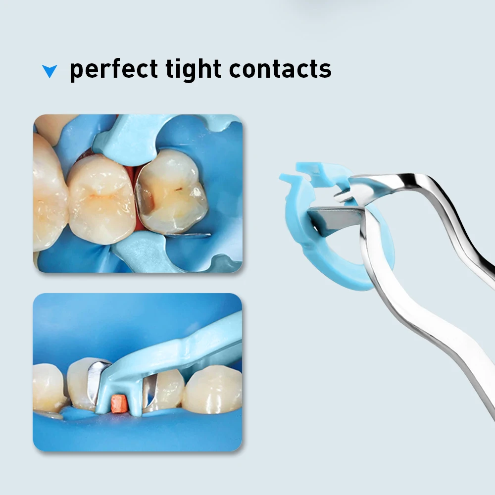 4 unids/set de anillo de sujeción de resina Dental, anillo separador, soporte de Matrices contorneadas seccionales, abrazadera fija Autoclavable