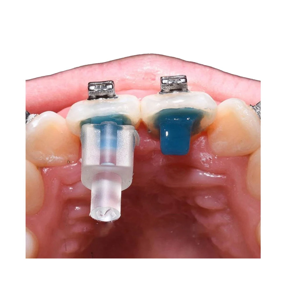 Materiales Dentales Mini accesorios de ortodoncia, soporte de molde de inyección, botón Lingual