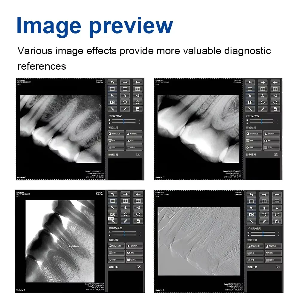JUMTOP-Sensor Dental de rayos X Digital, sistema de imagen intraoral de radiografía, transmisión rápida, tamaño pequeño/grande