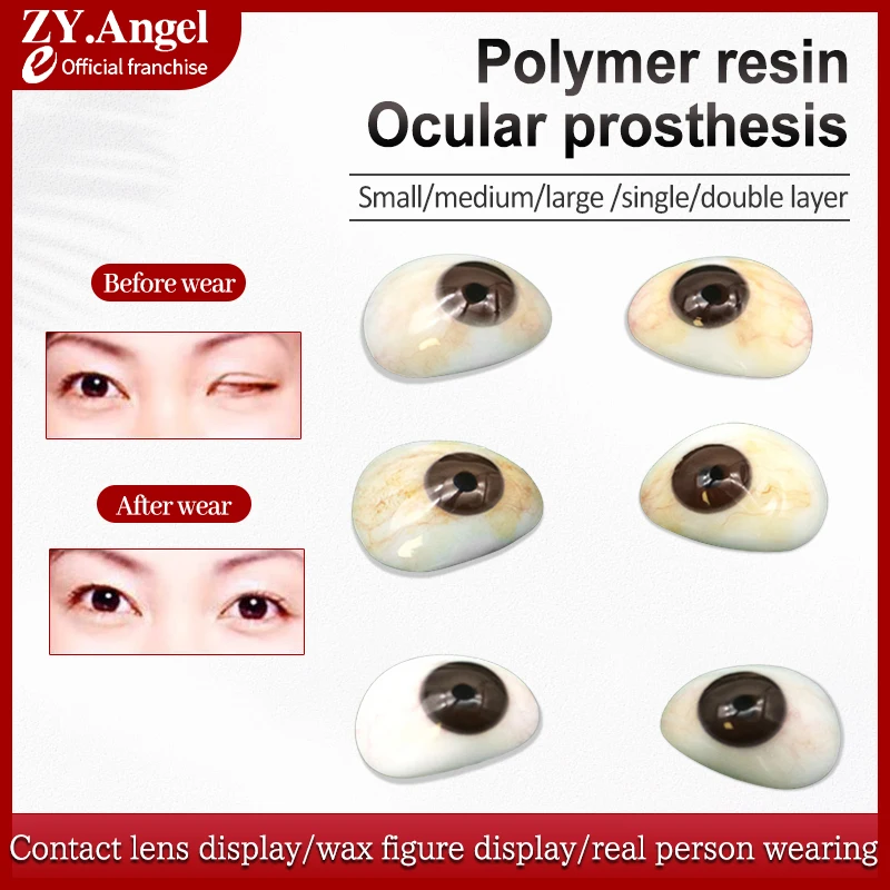 Prótesis ocular de resina para ojos discapacitados después de la eliminación de la atrofia del globo ocular con prótesis ocular artificial