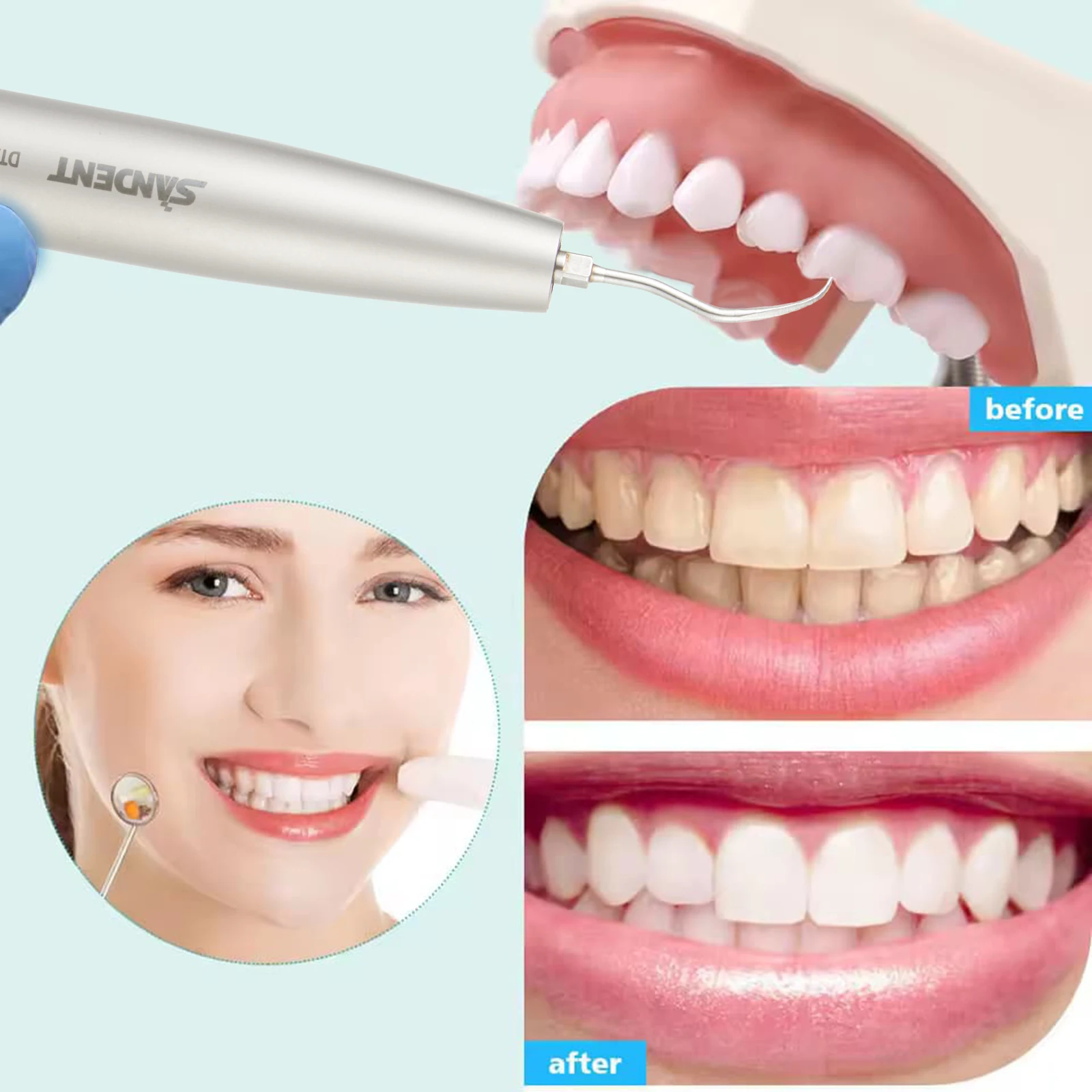 Escalador de aire de fibra óptica Dental SONICflex Sonic L compatible con acoplamiento Led multiflex KaVo/acoplador LED GK