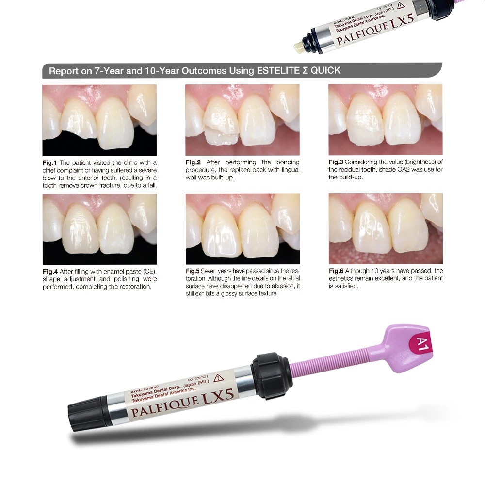 Tokuyama Palfique LX5 Material compuesto de curado ligero de resina restauradora Dental 3,8 g/unidad para uso Dental