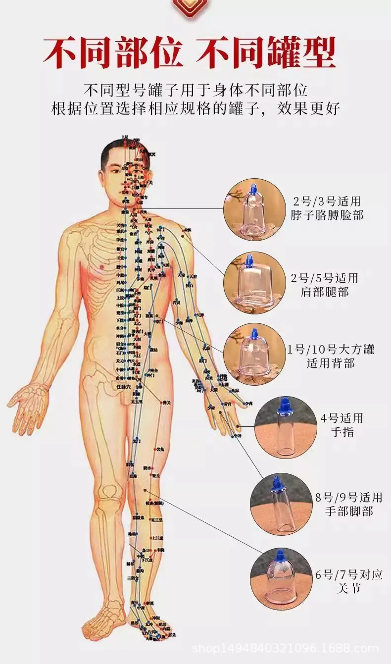 Set de Terapia de Ventosas al Vacío, 10 Ventosas de Plástico para Masaje, Masajeador Corporal Doméstico con Ventosas al Vacío