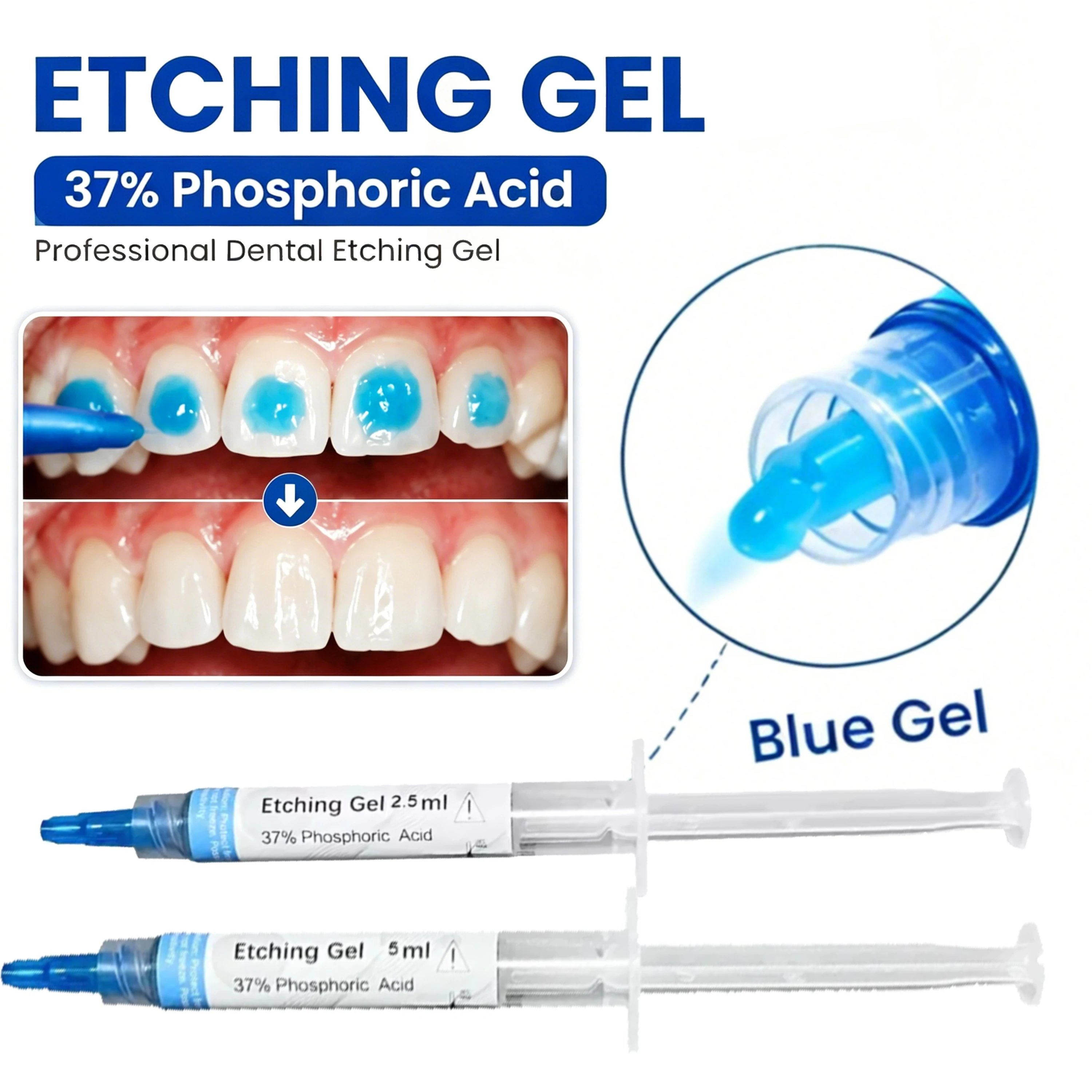 Gel de grabado dental con ácido fosfórico al 32%, 35%, 37% (opciones multimarca y multitamaño: 5ml/10ml/50ml) para adhesión universal + 5 agujas