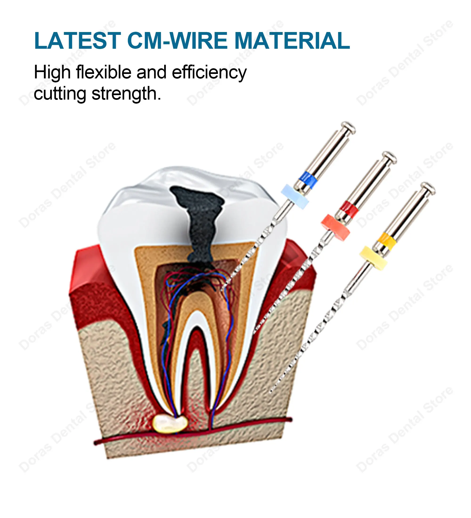 Instrumental Dental Glin: Limas Endodónticas de Retratamiento para Remover Material de Relleno, Limas Endodónticas Rotatorias de Niti de Alta Calidad