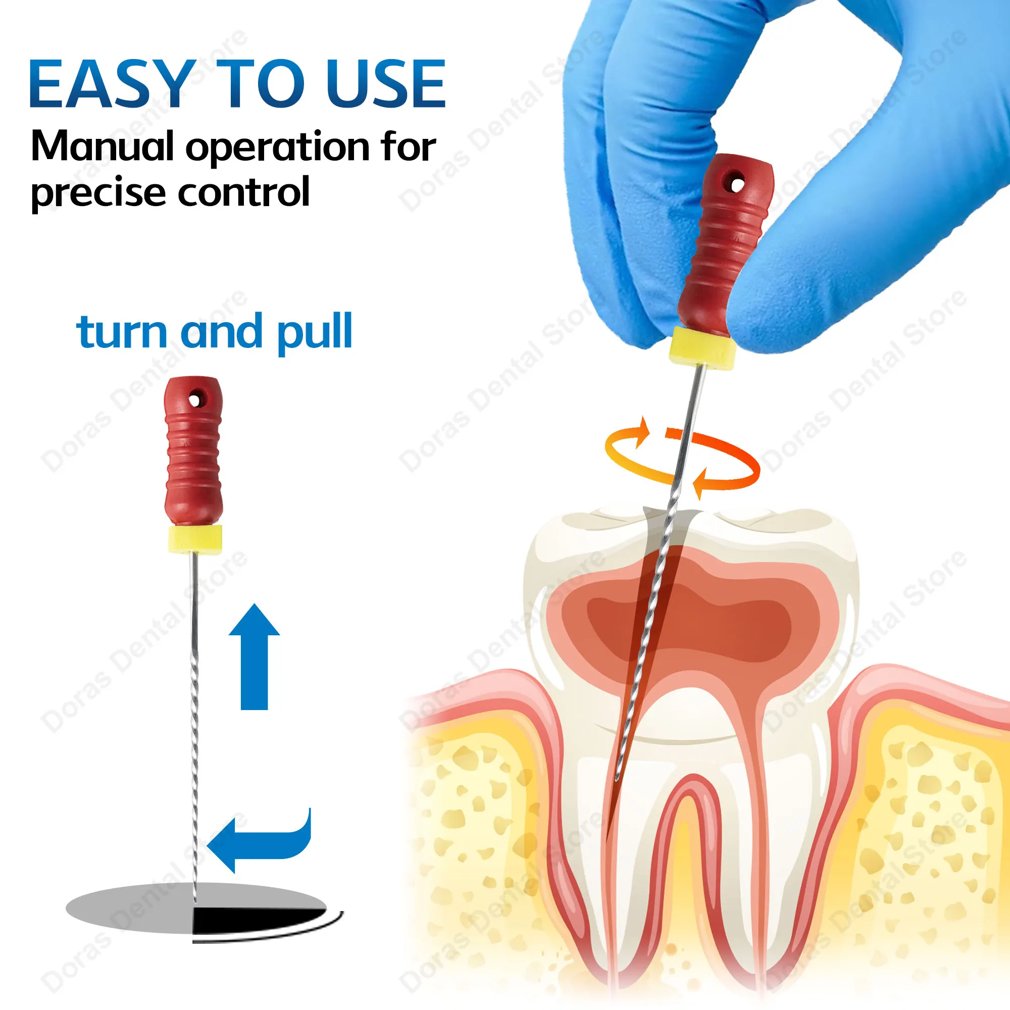 Lima endodóntica Glin NITI, instrumento dental de uso manual para el tratamiento de conductos radiculares y la preparación de los mismos, utilizado en endodoncia.