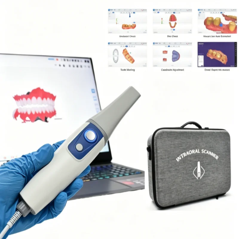 Escáner Intraoral Digital Dental, Escaneo Inteligente con IA, Visor 3D en Línea