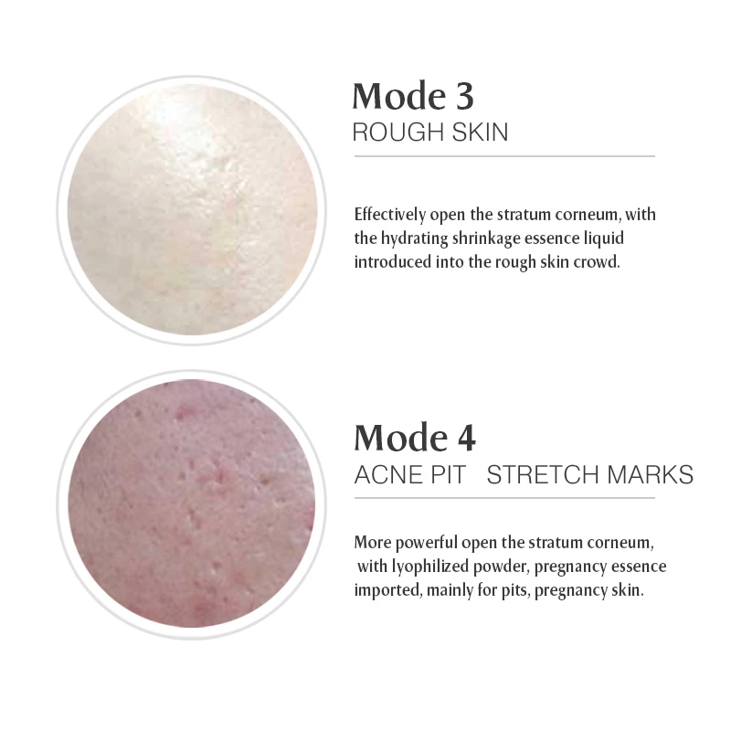 Dispositivo de belleza de alta frecuencia inalámbrico Derma Pen profesional de 5 velocidades con 2 cartuchos de agujas reemplazables