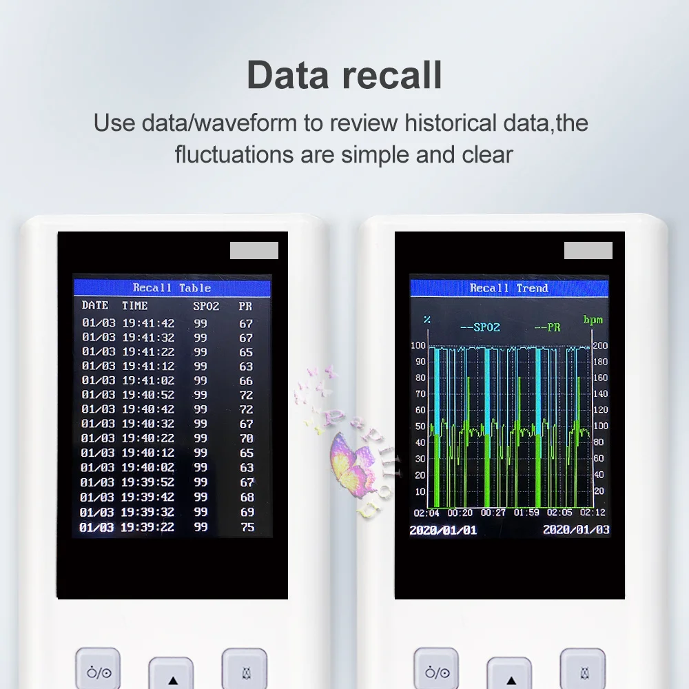 Oxímetro de Pulso Portátil Veterinario, Monitor de Signos Vitales SPO2 PR PI, Monitor de Frecuencia Cardíaca con Memoria, para Adultos, Neonatos, Mascotas, Hospitales, Clínicas y Hogares