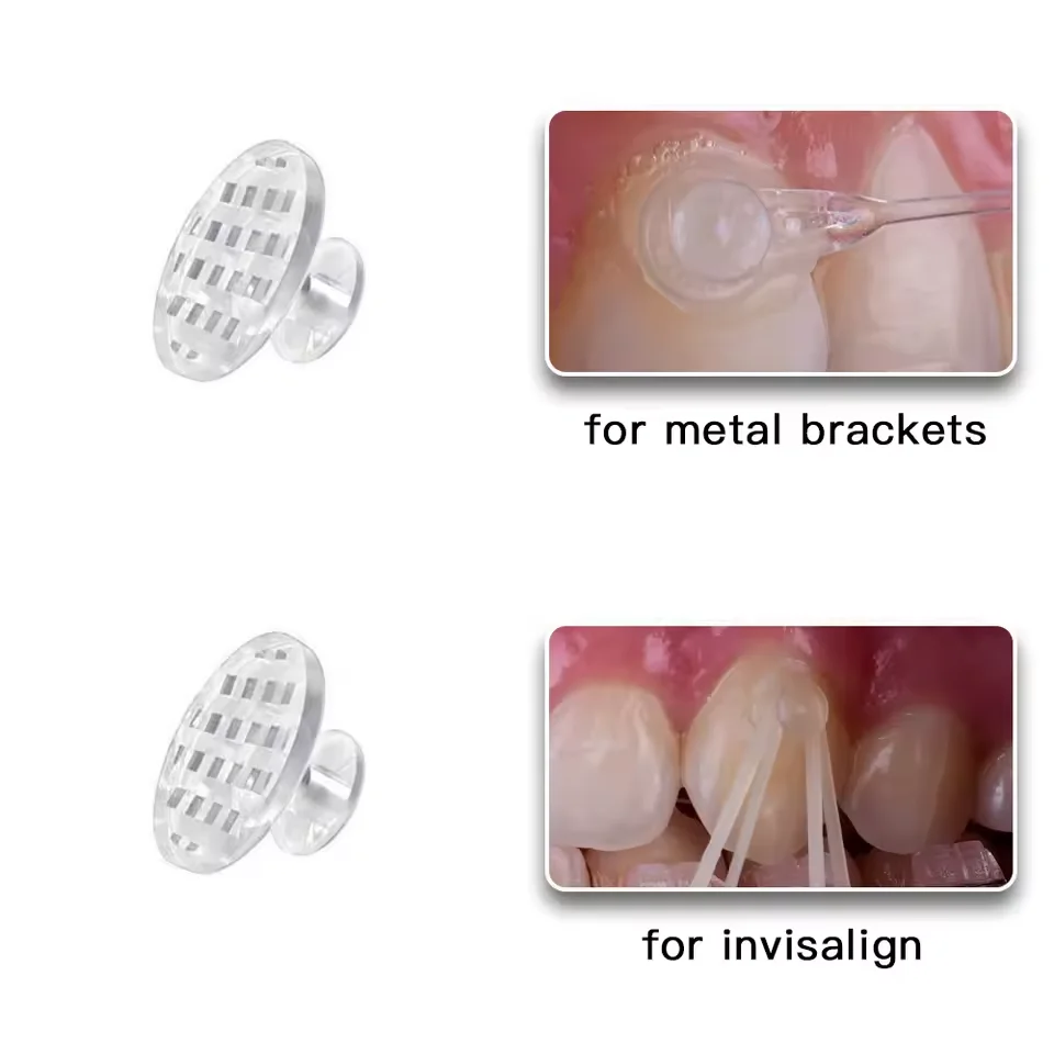 10 unidades de ganchos dentales de ortodoncia crimpables - Botón lingual, ganchos curvos largos con base de malla adherible, derecha/izquierda