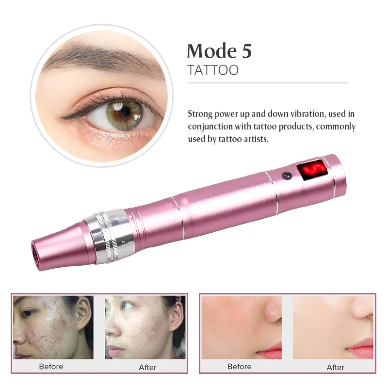Dispositivo de belleza de alta frecuencia inalámbrico Derma Pen profesional de 5 velocidades con 2 cartuchos de agujas reemplazables