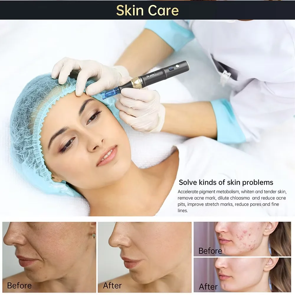 Dr. pen Original A8S inalámbrico Derma Pen piel Microneedling pluma profesional con 30 cartuchos de agujas Micro agujas cuidado de la piel