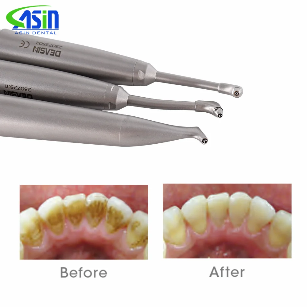 Boquillas y puntas de repuesto para pulidor dental de aire, accesorios para arenadora y pulidor de profilaxis