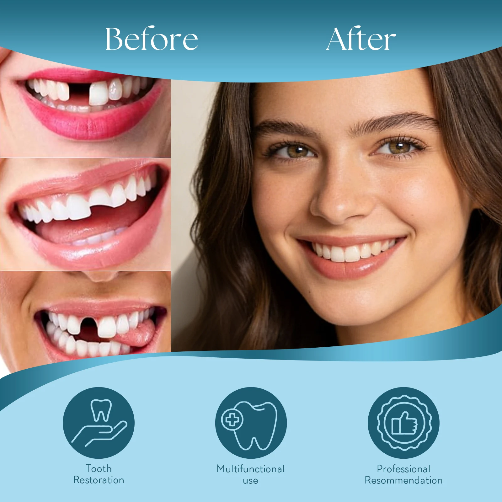 Kit de Dentadura Postiza Temporal DIY con Dientes Superiores e Inferiores, Tiras de Cera y Modelos de Yeso, Herramienta Reutilizable para Restauración y Reparación Dental