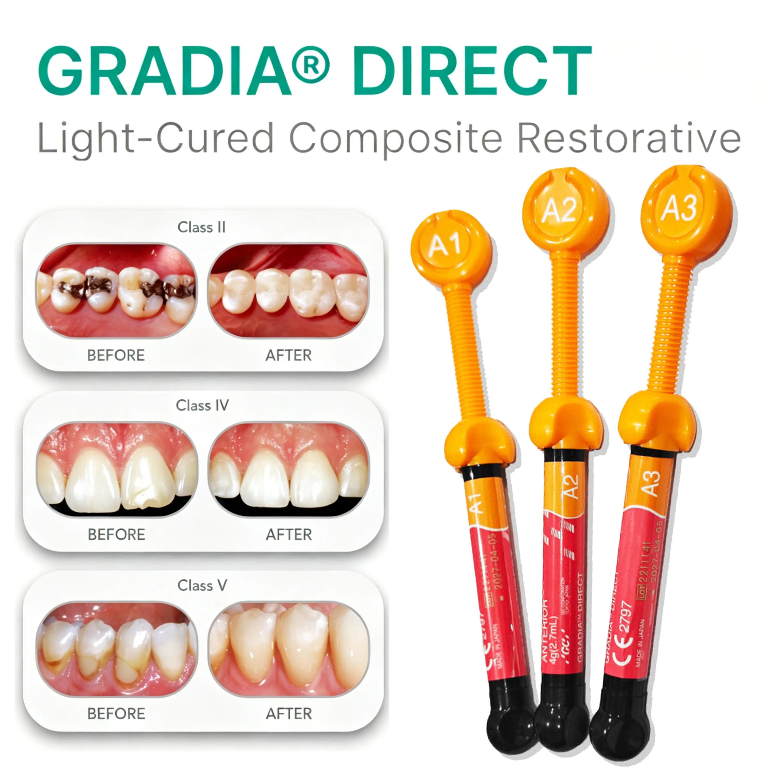 NUEVO Composite Restaurador GC Gradia Direct de Fotopolimerización 2.7mL, Material de Relleno de Nano Resina para Dientes Anteriores y Posteriores