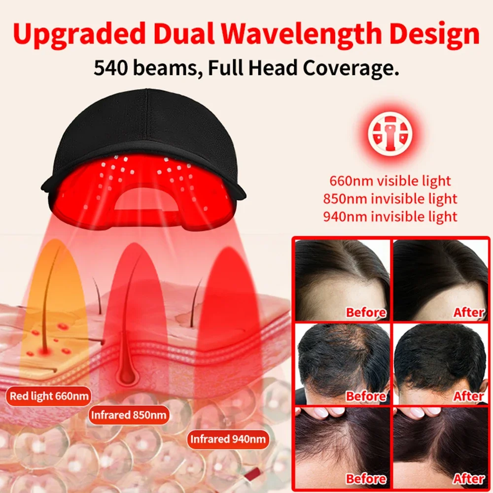 180 Uds LED infrarrojos 660nm y 850nm terapia de luz roja gorro para el crecimiento del cabello para el crecimiento del cabello Anti pérdida de cabello relajar el cuero cabelludo sombrero para el cuidado del cabello