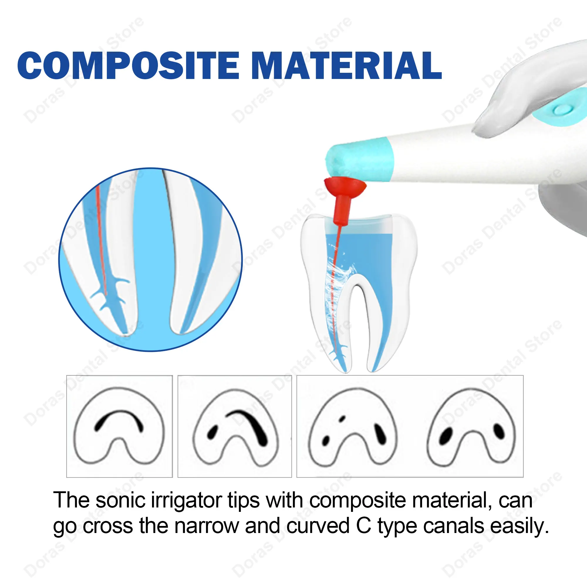 30 puntas de irrigador dental sónico, puntas activadoras sónicas Endo para instrumentos dentales de conducto radicular