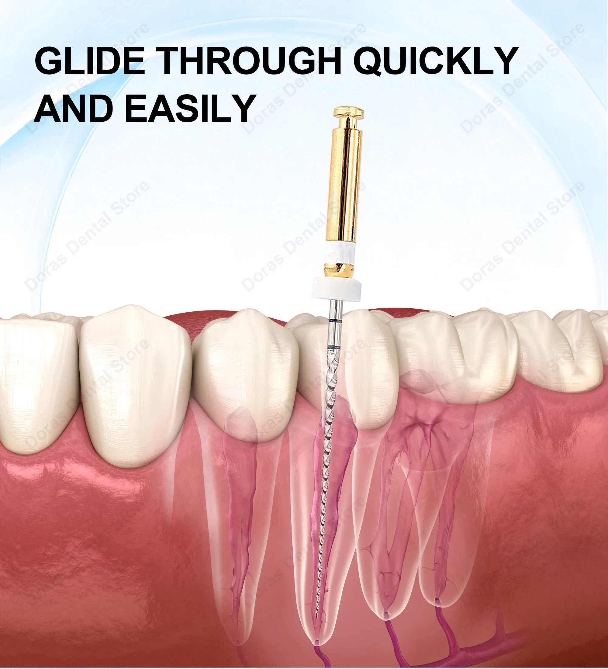 Limas de deslizamiento dental Glin, limas de endodoncia, deslizador 21/25 mm, limas rotatorias de endodoncia, materiales dentales, odontología