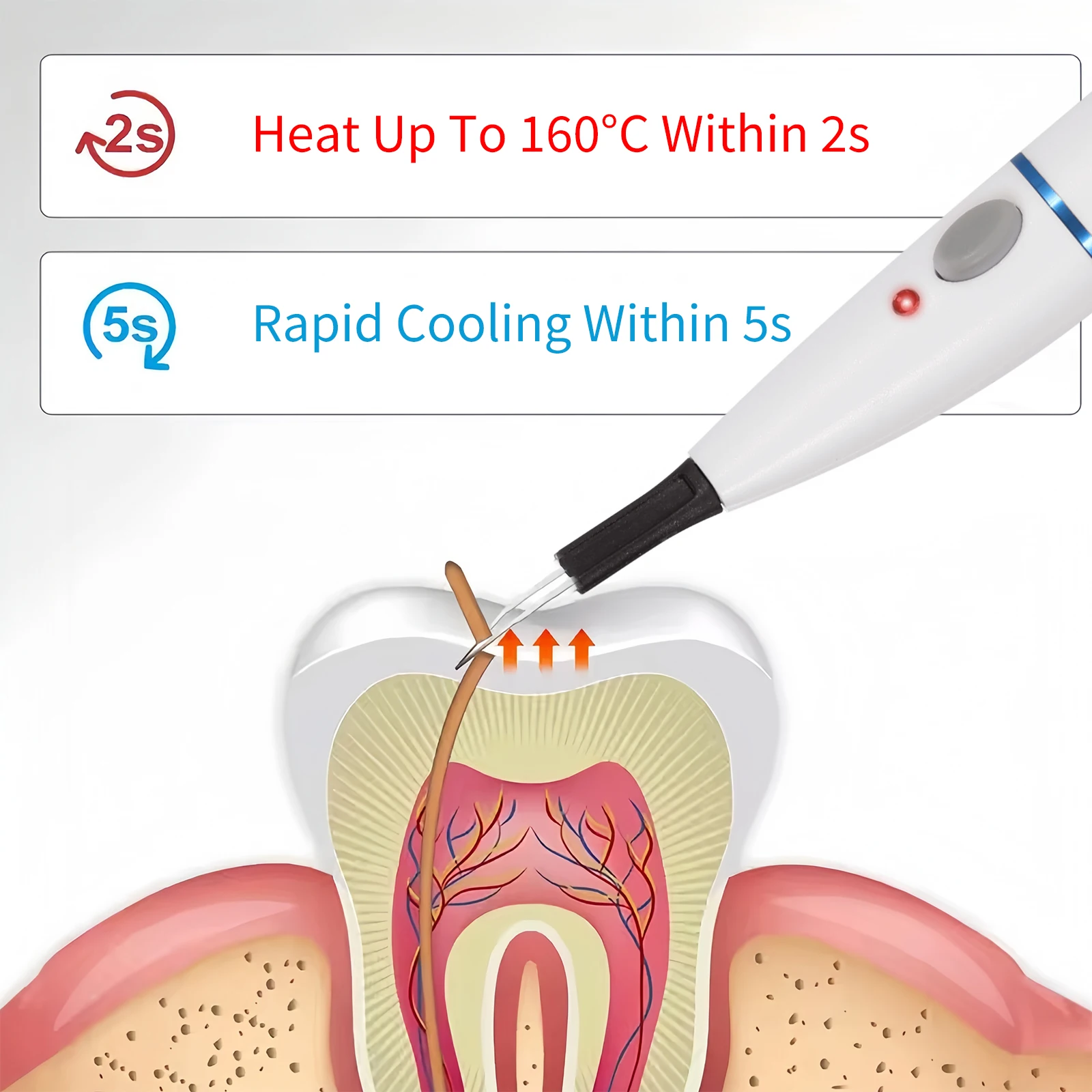 Cortador de Gutapercha Dental Inalámbrico SANDENT, Máquina de Calentamiento Dental para Clínica con 4 Puntas Calefactables