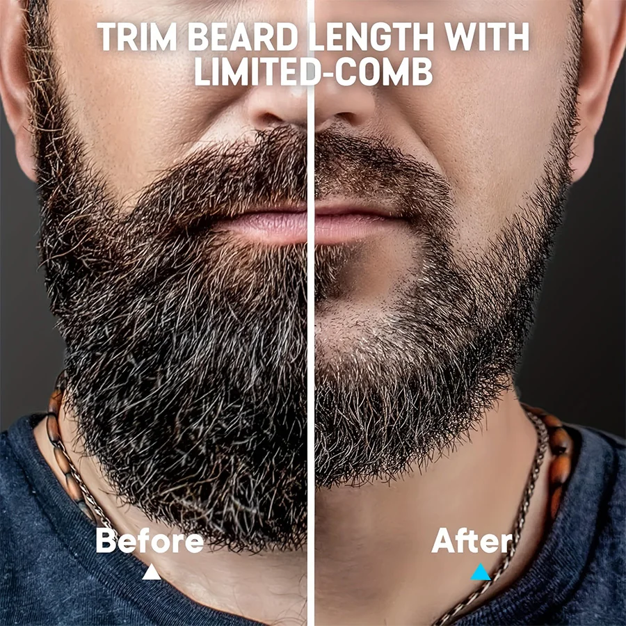 Recortadora de Barba para Hombre, Recortadora con Dial de Precisión - Afeitadora Facial - 20 Ajustes de Longitud, Recortadora Impermeable para Uso en Seco/Húmedo