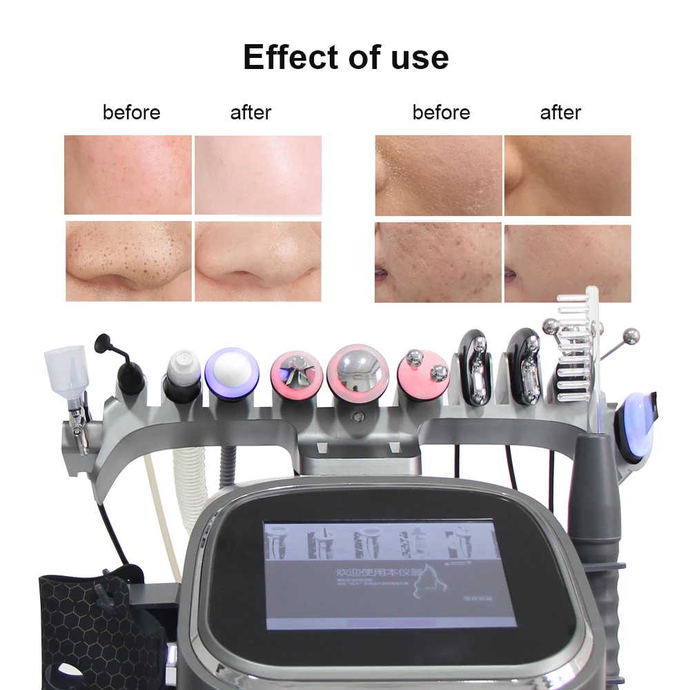 AOKO Máquina Multifuncional 12 en 1 para Limpieza Profunda, Eliminación de Puntos Negros, Cuidado Facial con Agua, Oxígeno e Hidrógeno para Uso en SPA en Casa