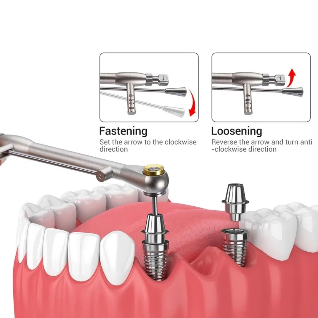 Kit Protésico Universal para Implantes Dentales, Llave de Torque, Destornilladores, Herramientas para Extracción de Implantes Dentales