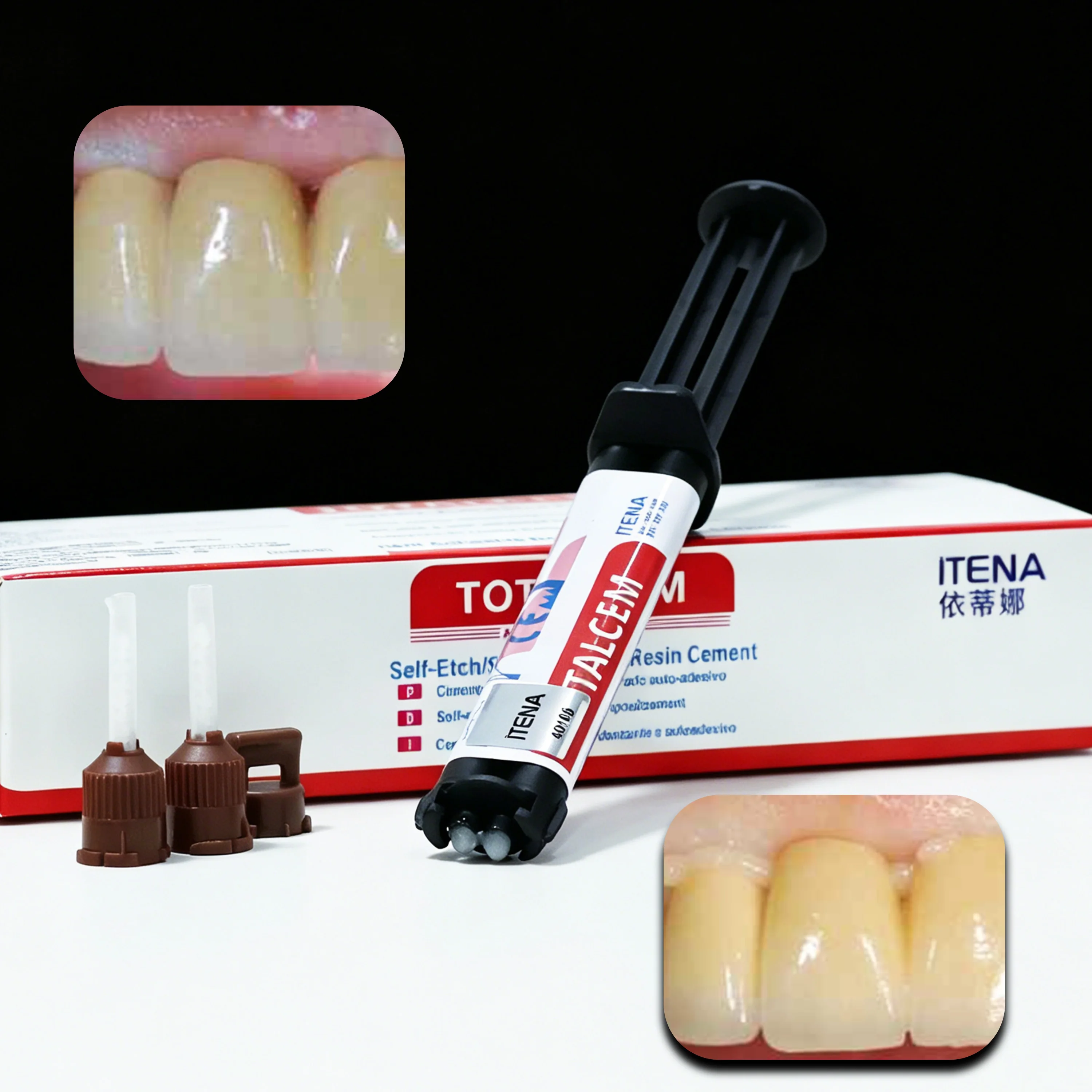 ITENA TOTALCEM Cemento de Resina de Doble Curado Autoadhesivo 8g - Adhesión Permanente para Coronas Dentales, Carillas e Incrustaciones