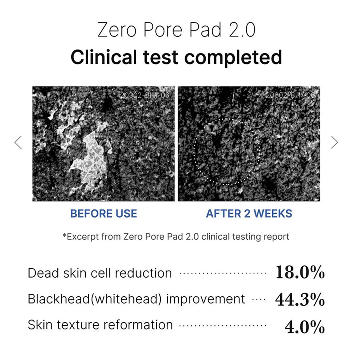 Medicube ZERO PORE PAD 2.0, Algodón Preimpregnado de Doble Textura, Fórmula Hidratante y Calmante, Cuidado de la Piel Coreano, K-Beauty, Maquillaje Coreano