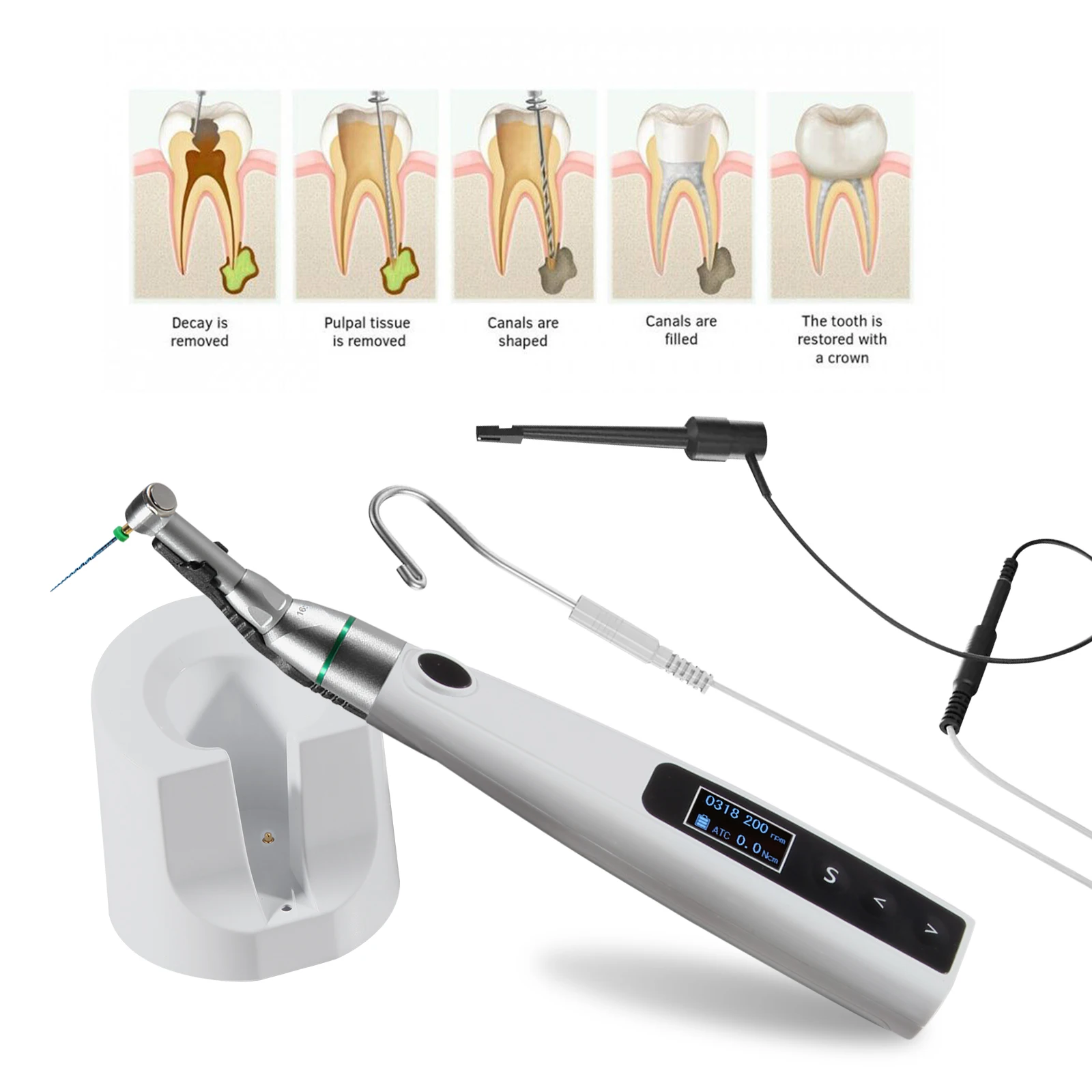Motor Endo Dental ReciprocanteLED/No-LED 16:1 Endodoncia ​   Tratamiento del conducto radicular / Archivos NiTi
