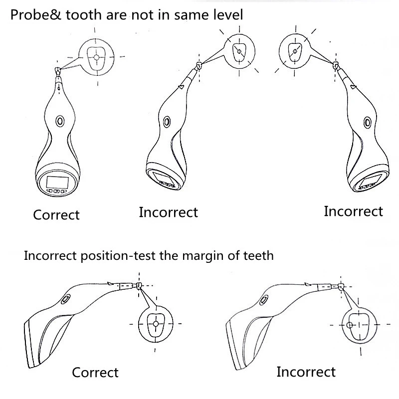 Comparador de Color de Dientes JUMTOP, Guía de Tonos Digital con Cuatro Sistemas Colorimétricos