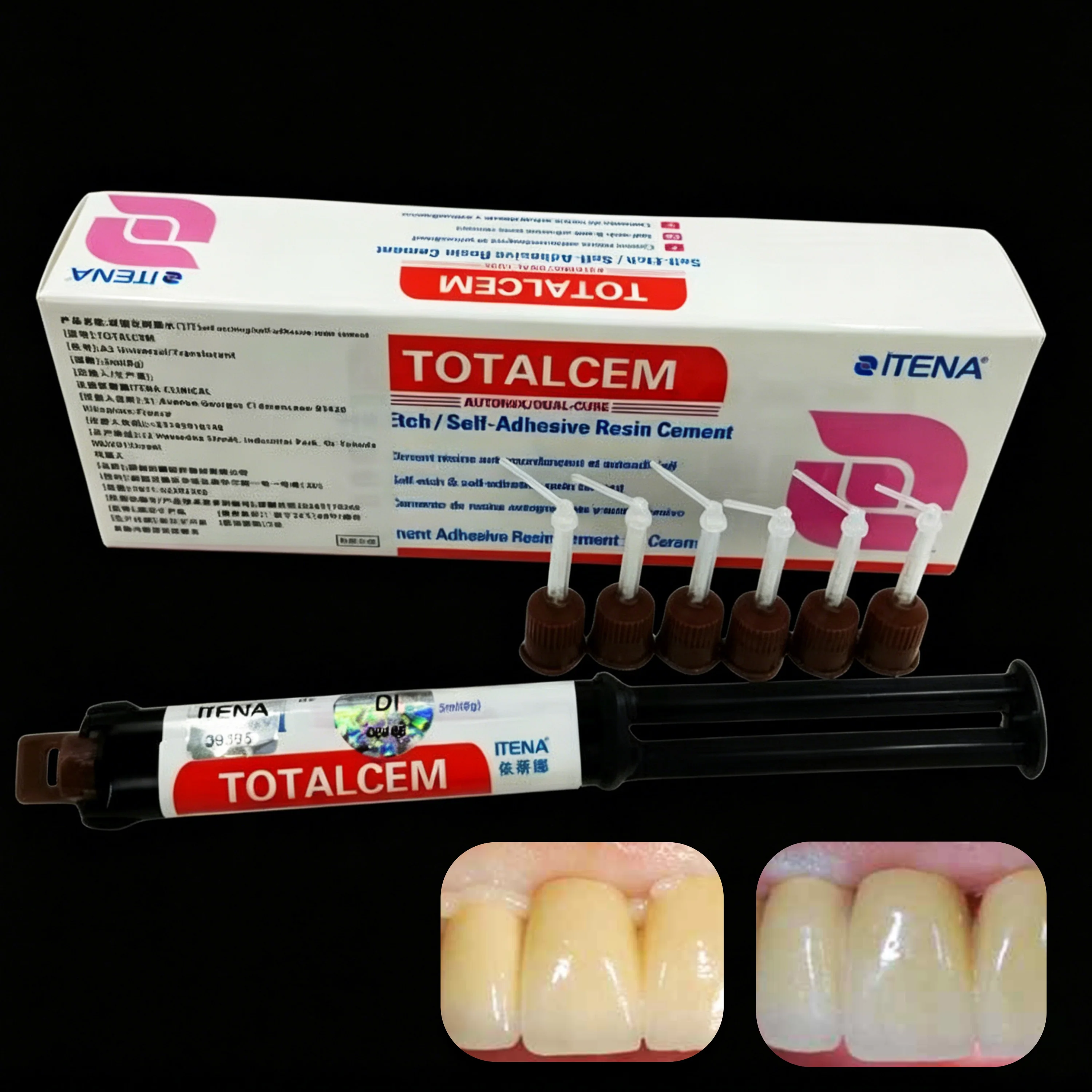 ITENA TOTALCEM Cemento de Resina de Doble Curado Autoadhesivo 8g - Adhesión Permanente para Coronas Dentales, Carillas e Incrustaciones
