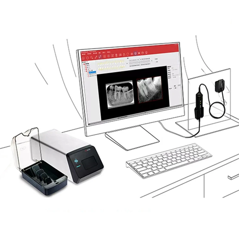 Escáner Psp de placa de fósforo de imagen Digital Dental JUMTOP, escáner de placa de imagen de rayos X de dientes de alta definición